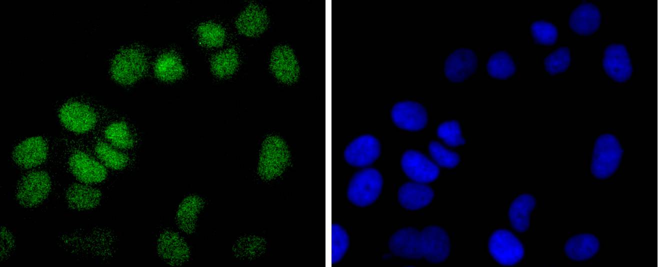 Fig2:; ICC staining Histone H2B(mono methyl R79) in Hela cells (green). The nuclear counter stain is DAPI (blue). Cells were fixed in paraformaldehyde, permeabilised with 0.25% Triton X100/PBS.