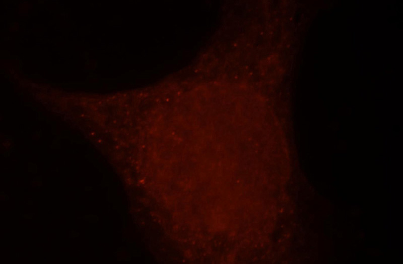 Immunofluorescent analysis of MCF-7 cells, using RHOB antibody Catalog No:114658 at 1:25 dilution and Rhodamine-labeled goat anti-rabbit IgG (red).