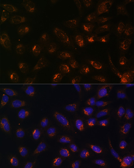 Immunofluorescence - ITPR1 Polyclonal Antibody 