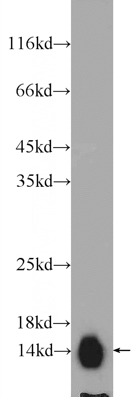 rat brain tissue were subjected to SDS PAGE followed by western blot with Catalog No:108315(ATP6V1G2 Antibody) at dilution of 1:600