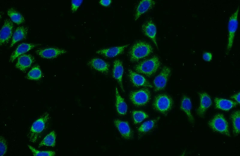 Immunofluorescent analysis of PC-3 cells using Catalog No:110065(DPH2 Antibody) at dilution of 1:25 and Alexa Fluor 488-congugated AffiniPure Goat Anti-Rabbit IgG(H+L)
