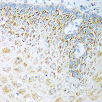 Immunohistochemistry - FDXR Polyclonal Antibody 