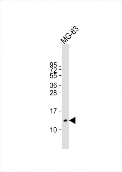 Anti-OSTC Antibody (C16) at 1:2000 dilution + MG-63 whole cell lysatennLysates/proteins at 20 u03bcg per lane.  nnSecondarynGoat Anti-Rabbit IgG,   (H+L),  Peroxidase conjugated at 1/10000 dilution.  nnPredicted band size: 11 kDannBlocking/Dilution buffer: 5% NFDM/TBST.