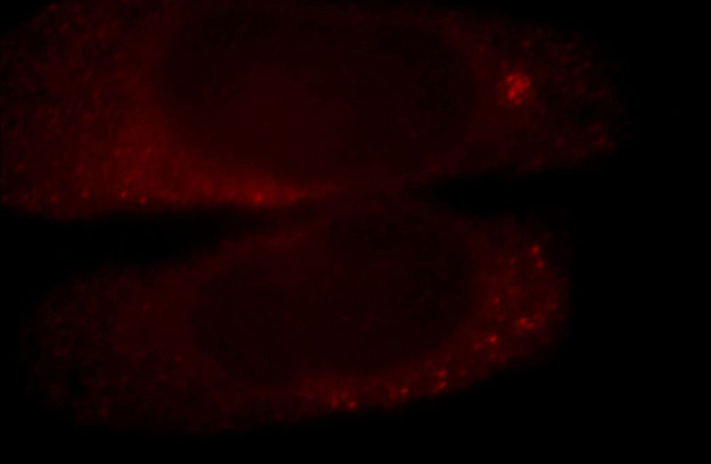 Immunofluorescent analysis of HepG2 cells, using CIT antibody Catalog No:109323 at 1:25 dilution and Rhodamine-labeled goat anti-rabbit IgG (red).