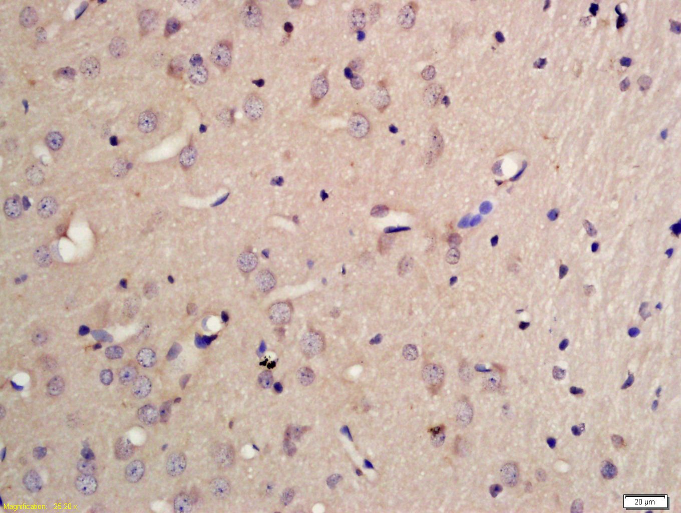 Fig2: Tissue/cell: rat brain tissue; 4% Paraformaldehyde-fixed and paraffin-embedded;; Antigen retrieval: citrate buffer ( 0.01M, pH 6.0 ), Boiling bathing for 15min; Block endogenous peroxidase by 3% Hydrogen peroxide for 30min; Blocking buffer (normal goat serum,C-0005) at 37℃ for 20 min;; Incubation: Anti-PCDHB10 Polyclonal Antibody, Unconjugated 1:200, overnight at 4℃, followed by conjugation to the secondary antibody(SP-0023) and DAB(C-0010) staining