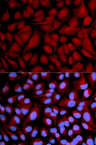 Immunofluorescence - CASK Polyclonal Antibody 