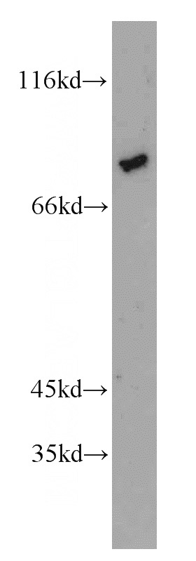 mouse thymus tissue were subjected to SDS PAGE followed by western blot with Catalog No:117031(ZNF750 antibody) at dilution of 1:500