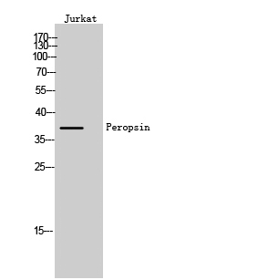 Fig1:; Western Blot analysis of Jurkat cells using Peropsin Polyclonal Antibody