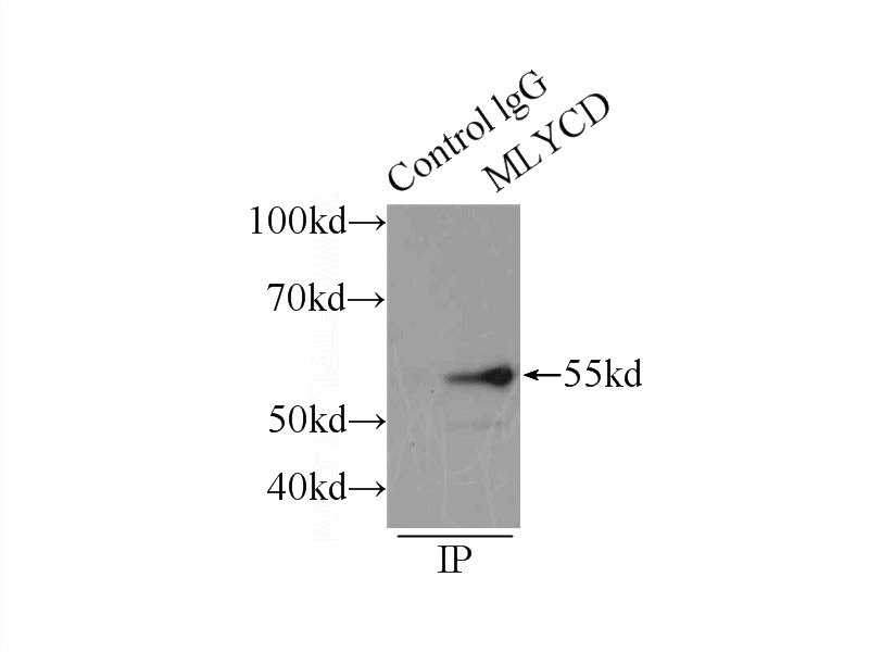 IP Result of anti-MLYCD (IP:Catalog No:112689, 4ug; Detection:Catalog No:112689 1:500) with mouse heart tissue lysate 5000ug.