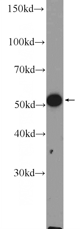 mouse skin tissue were subjected to SDS PAGE followed by western blot with Catalog No:109283(CHRNA9 Antibody) at dilution of 1:1000