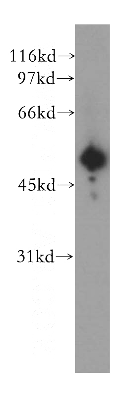 human serum tissue were subjected to SDS PAGE followed by western blot with Catalog No:111168(GSK3A antibody) at dilution of 1:300
