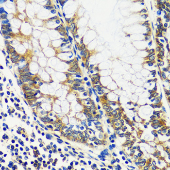 Immunohistochemistry - CCDC124 Polyclonal Antibody 
