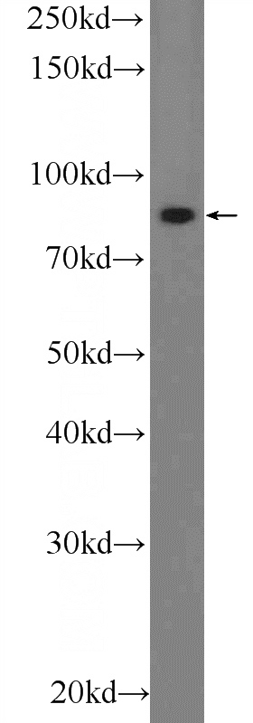 SH-SY5Y cells were subjected to SDS PAGE followed by western blot with Catalog No:113947(PLCD3 Antibody) at dilution of 1:600
