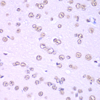 Immunohistochemistry - NONO Polyclonal Antibody 