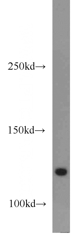 mouse brain tissue were subjected to SDS PAGE followed by western blot with Catalog No:108129(APBA2 antibody) at dilution of 1:500