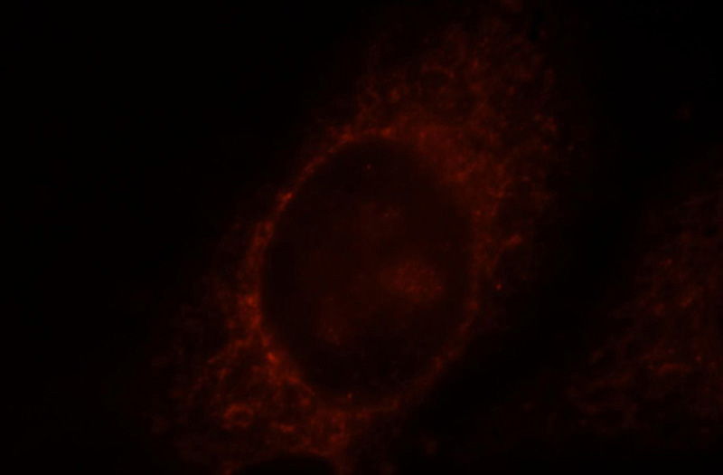 Immunofluorescent analysis of HepG2 cells, using Catalog No:117307 and Rhodamine-labeled goat anti-rabbit IgG (red).