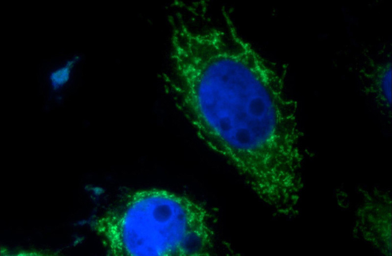 Immunofluorescent analysis of A431 cells using Catalog No:109211(CHCHD10 Antibody) at dilution of 1:25 and Alexa Fluor 488-congugated AffiniPure Goat Anti-Rabbit IgG(H+L)