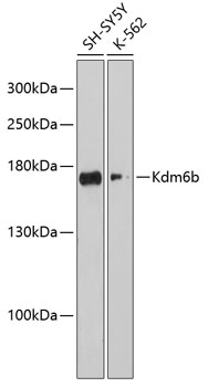Western blot - Kdm6b Polyclonal Antibody 