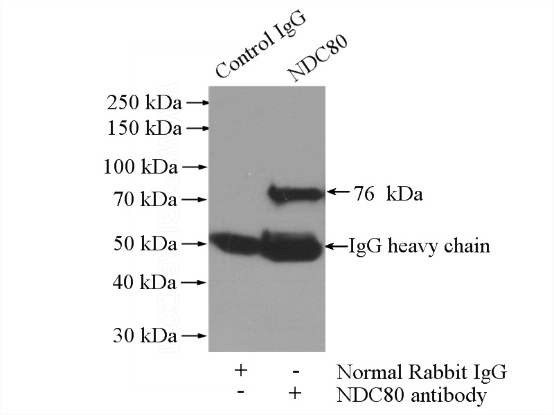 IP Result of anti-NDC80 (IP:Catalog No:113052, 4ug; Detection:Catalog No:113052 1:500) with A2780 cells lysate 960ug.