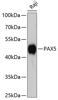 Western blot - PAX5 Polyclonal Antibody 