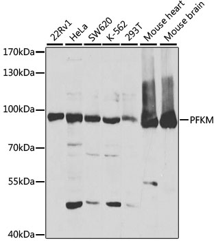Western blot - PFKM Polyclonal Antibody 