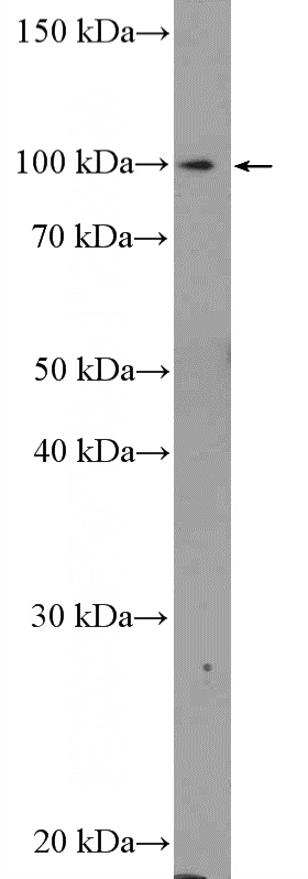 HEK-293 cells were subjected to SDS PAGE followed by western blot with Catalog No:108669(C15orf39 Antibody) at dilution of 1:600