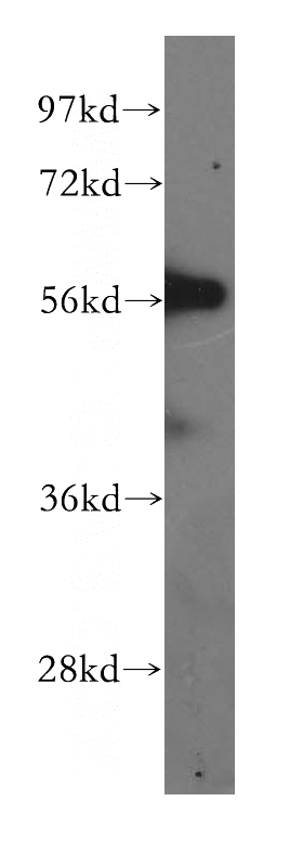 human brain tissue were subjected to SDS PAGE followed by western blot with Catalog No:114448(RABIN8 antibody) at dilution of 1:2000