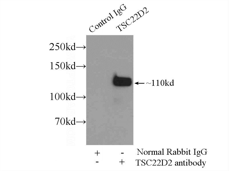 IP Result of anti-TSC22D2 (IP:Catalog No:116424, 5ug; Detection:Catalog No:116424 1:300) with HepG2 cells lysate 2500ug.