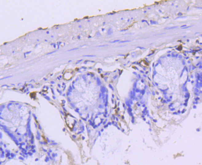 Immunohistochemistry - KRT15 Monoclonal Antibody 