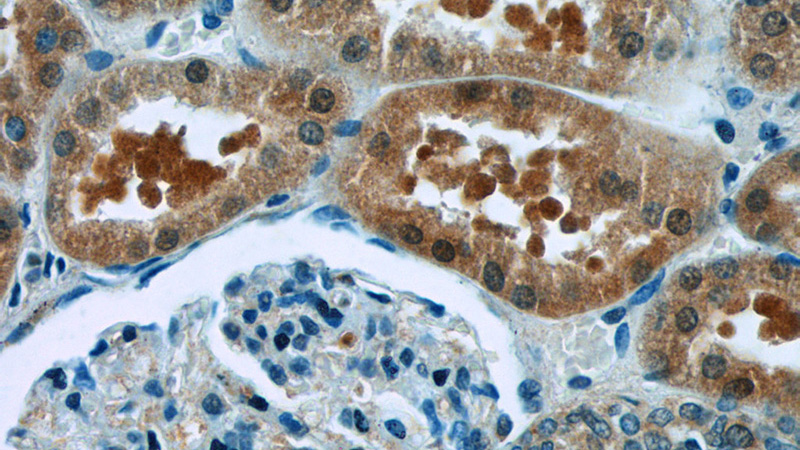 Immunohistochemistry of paraffin-embedded human kidney tissue slide using Catalog No:108365(BAX Antibody) at dilution of 1:50 (under 40x lens)