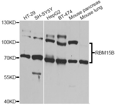 Western blot - RBM15B Polyclonal Antibody 