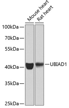Western blot - UBIAD1 Polyclonal Antibody 
