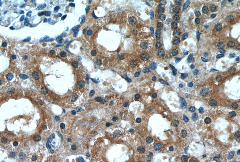 Immunohistochemistry of paraffin-embedded human kidney slide using Catalog No:107549(ZYX Antibody) at dilution of 1:50