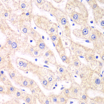 Immunohistochemistry - PSMF1 Polyclonal Antibody 