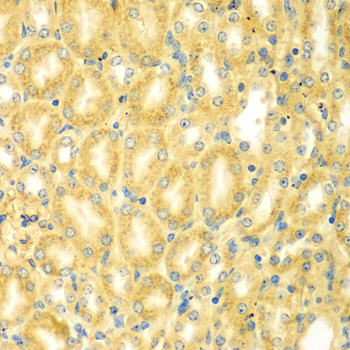 Immunohistochemistry - PDE4DIP Polyclonal Antibody 