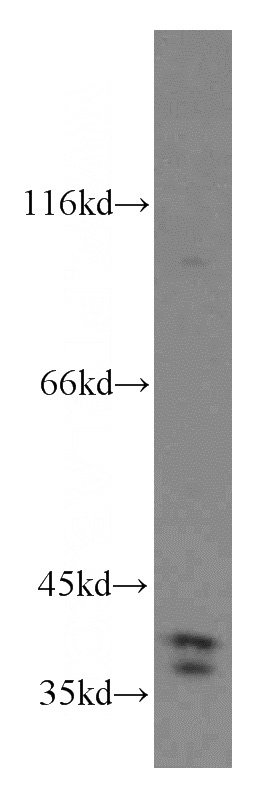 mouse liver tissue were subjected to SDS PAGE followed by western blot with Catalog No:116420(TRUB1 antibody) at dilution of 1:300