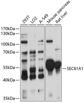 Western blot - SEC61A1 Polyclonal Antibody 