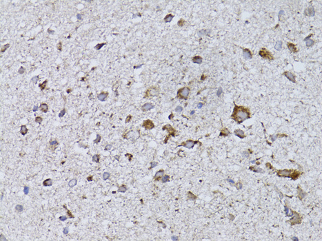 Immunohistochemistry - RARA Polyclonal Antibody 