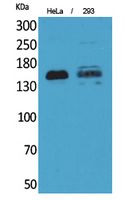 Fig1:; Western Blot analysis of HeLa, 293 cells using CD148 Polyclonal Antibody.. Secondary antibody（catalog#：HA1001) was diluted at 1:20000 cells nucleus extracted by Minute TM Cytoplasmic and Nuclear Fractionation kit (SC-003,Inventbiotech,MN,USA).