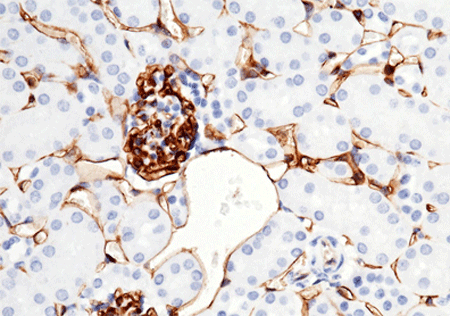 CD38 Antibody, Rabbit MAb, Immunohistochemistry
