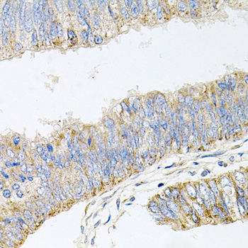 Immunohistochemistry - GP2 Polyclonal Antibody 