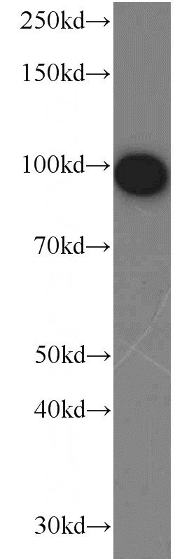 human serum tissue were subjected to SDS PAGE followed by western blot with Catalog No:109446(CFB antibody) at dilution of 1:800