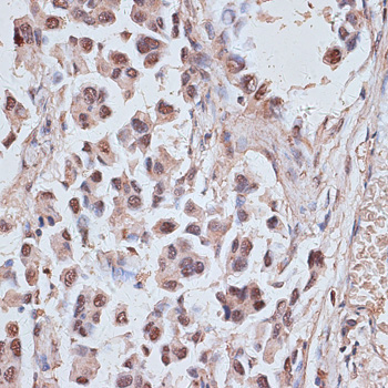 Immunohistochemistry - NR5A2 Polyclonal Antibody 