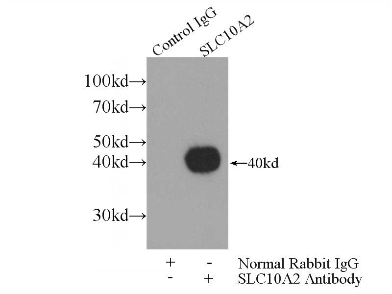 IP Result of anti-SLC10A2 (IP:Catalog No:108217, 4ug; Detection:Catalog No:108217 1:300) with mouse kidney tissue lysate 4000ug.