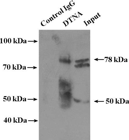 IP Result of anti-DTNA (IP:Catalog No:110033, 4ug; Detection:Catalog No:110033 1:1000) with mouse brain tissue lysate 4000ug.