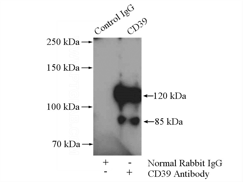 IP Result of anti-ENTPD1 (IP:Catalog No:109034, 4ug; Detection:Catalog No:109034 1:800) with mouse liver tissue lysate 4000ug.