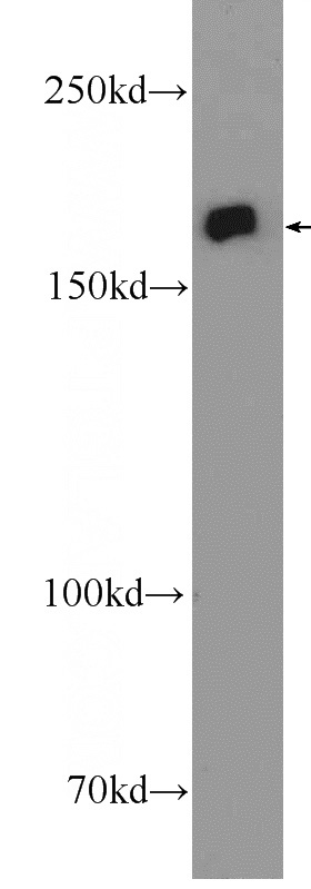 HepG2 cells were subjected to SDS PAGE followed by western blot with Catalog No:111826(IQGAP3 Antibody) at dilution of 1:600