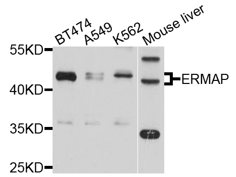 Western blot - ERMAP Polyclonal Antibody 