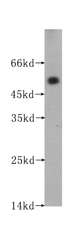 human testis tissue were subjected to SDS PAGE followed by western blot with Catalog No:107558(ACPP antibody) at dilution of 1:400