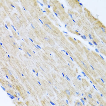 Immunohistochemistry - ABCB8 Polyclonal Antibody 
